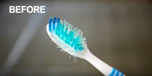 before-toothbrush