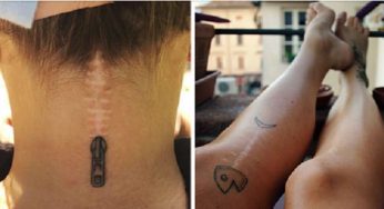 10+ Удивительных татуировок, которые превращают шрамы в произведения искусства